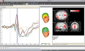 Neuromatch and the Power of Predictive Analytics: How to Forecast Consumer Behavior